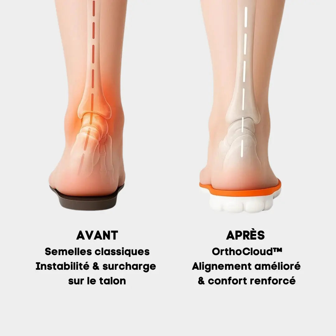 OrthoCloud™ - Semelles Orthopédiques CloudStep®